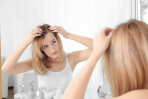 A Young Woman Suffering From Alopecia Caused By Taxotere