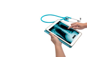 x-ray picture in tablet representing the need for an essure lawsuit